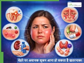 चेहरे पर अचानक सूजन आने के पीछे क्या कारण हो सकते हैं? कहीं कोई गंभीर समस्या तो नहीं