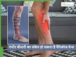 पैरों में दर्द सूजन या खुजली हो सकता है नसों की इस बड़ी बीमारी का संकेत, गलती से भी न करें इग्नोर