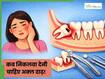 किस उम्र तक आ जानी चाहिए अक्ल दाढ़? जानें किन परिस्थितियों में डॉक्टर देते हैं इसे निकलवाने की सलाह
