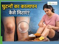 घुटने के कालेपन की वजह से नहीं पहन पा रहे शॉर्ट ड्रेस, ये 5 उपाय Darkness को मिटाने में हैं असरदार