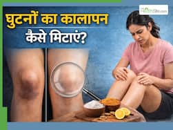 घुटने के कालेपन की वजह से नहीं पहन पा रहे शॉर्ट ड्रेस, ये 5 उपाय Darkness को मिटाने में हैं असरदार