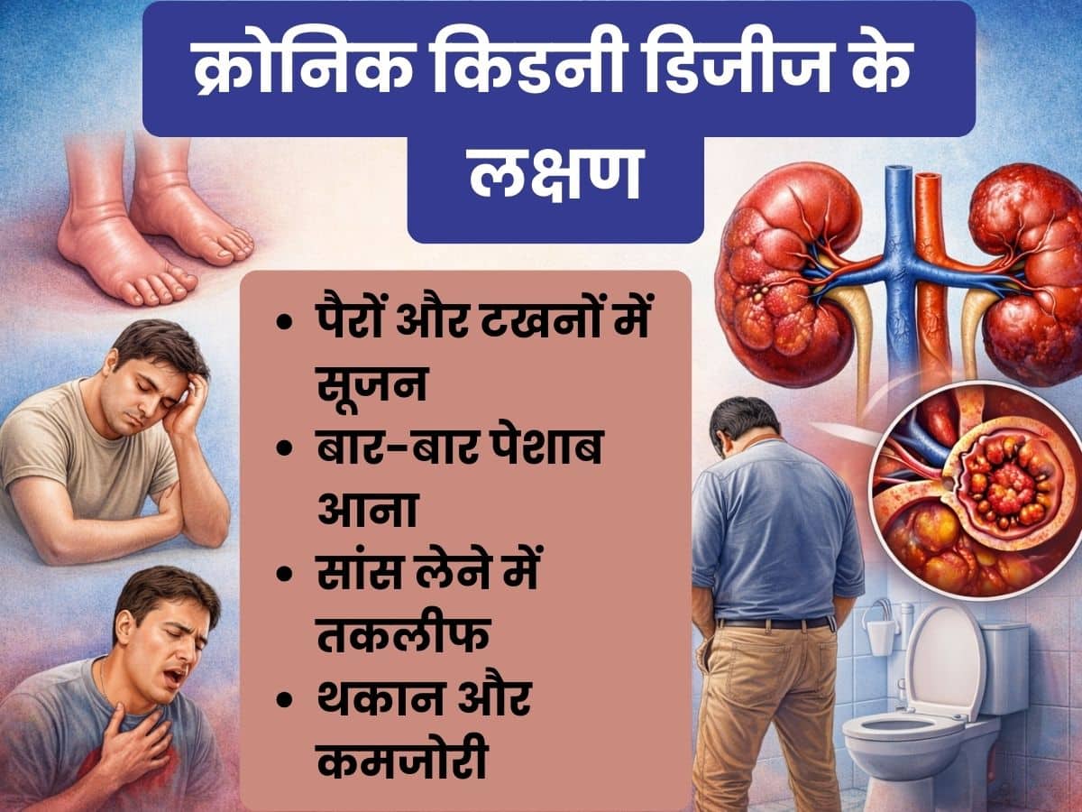 chronic kidney disease