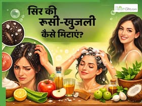 डैंड्रफ की वजह से सिर पर पपड़ी जम गई है तो लगाएं ये 5 चीजें, दूर हो जाएगी रूसी और खुजली डैंड्रफ की वजह से सिर पर पपड़ी जम गई है तो लगाएं ये 5 चीजें, दूर हो जाएगी रूसी और खुजली