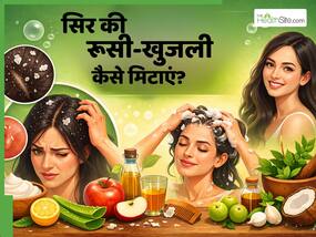 डैंड्रफ की वजह से सिर पर पपड़ी जम गई है तो लगाएं ये 5 चीजें, दूर हो जाएगी रूसी और खुजली