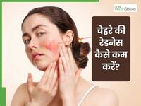 चेहरे की रेडनेस कम करने के लिए क्या लगाएं?