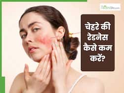 चेहरे की रेडनेस कम करने के लिए क्या लगाएं?