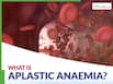 Anaemia is not always low iron: Doctor explains warning signs of aplastic anaemia