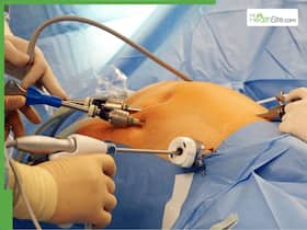 Bariatric surgery: Is weight-loss surgery really safe? What changes later in life? Bariatric surgery: Is weight-loss surgery really safe? What changes later in life?
