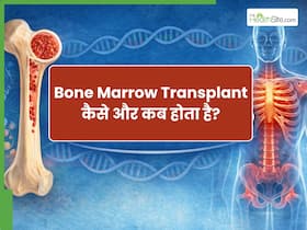 Bone Marrow Transplant कैसे और कब होता है? जानिए पूरी प्रक्रिया, किसे पड़ती है जरूरत और कितनी है सफलता की संभावना Bone Marrow Transplant कैसे और कब होता है? जानिए पूरी प्रक्रिया, किसे पड़ती है जरूरत और कितनी है सफलता की संभावना
