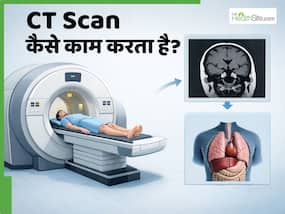 CT Scan क्या होता है? जानें डॉक्टर इस टेस्ट को कराने की कब देते हैं सलाह
