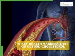 Cardiovascular risk: 6 key health markers that go beyond total cholesterol