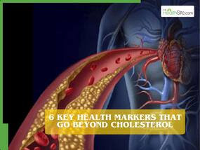 Cardiovascular risk: 6 key health markers that go beyond total cholesterol
