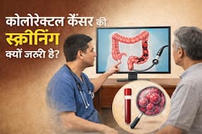 Colorectal cancer से बचाव के लिए स्क्रीनिंग क्यों है जरूरी? डॉक्टर बता रहे हैं किस उम्र से करानी चाहिए जांच Colorectal cancer से बचाव के लिए स्क्रीनिंग क्यों है जरूरी? डॉक्टर बता रहे हैं किस उम्र से करानी चाहिए जांच