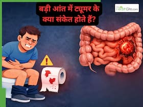 बार-बार कब्ज या खून आना सिर्फ पाचन समस्या नहीं, डॉक्टर ने दिया कोलोरेक्टल कैंसर का संकेत बार-बार कब्ज या खून आना सिर्फ पाचन समस्या नहीं, डॉक्टर ने दिया कोलोरेक्टल कैंसर का संकेत