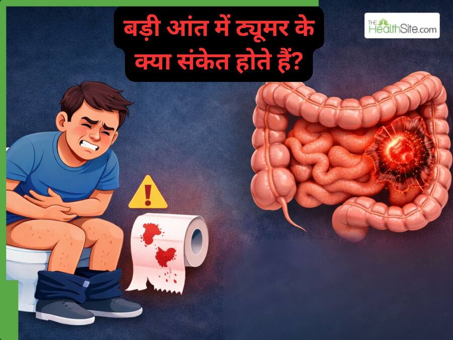 बार-बार कब्ज या खून आना सिर्फ पाचन समस्या नहीं, डॉक्टर ने दिया कोलोरेक्टल कैंसर का संकेत