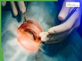 When is the right time to see cornea specialists? Expert reveals hidden eye risks you should never ignore