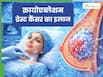 क्रायोएब्लेशन क्या है? जानें ब्रेस्ट कैंसर के इलाज में कैसे असरदार है यह सर्जरी