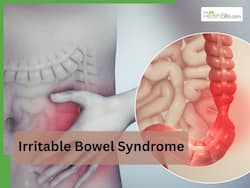 Expert reveals early signs of Irritable Bowel Syndrome you should not Ignore