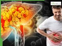 Fatty liver without alcohol? Expert explains why NAFLD is increasing among non-drinkers