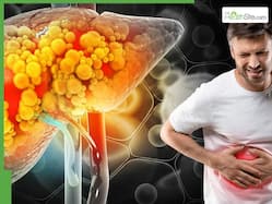 World Liver Day: Fatty liver on the rise in young Indians - how stress, sleep and diet are taking a toll