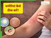 Summer Skin Care Guide: गर्मियों में खुजली, रैशेज और घमौरियां क्यों हो जाती हैं? काम आएंगे ये 3 घरेलू उपाय