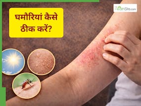 Summer Skin Care Guide: गर्मियों में खुजली, रैशेज और घमौरियां क्यों हो जाती हैं? काम आएंगे ये 3 घरेलू उपाय
