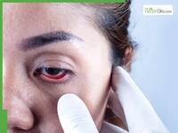 Glaucoma in India: Silent thief of sight, risk factors, early detection and treatment options