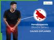 Blood In Semen: 5 Severe Medical Conditions That Can Cause Hematospermia