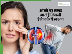 आंखों पर दिखाई देते हैं किडनी डैमेज के ये 5 लक्षण, 99 फीसदी लोग कर देते हैं इग्नोर