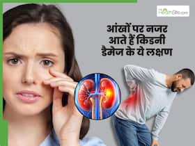 आंखों पर दिखाई देते हैं किडनी डैमेज के ये 5 लक्षण, 99 फीसदी लोग कर देते हैं इग्नोर