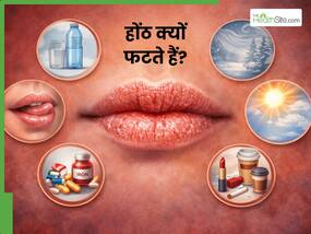 इन 6 कारणों से ड्राई होने लगती हैं लिप्स, डॉक्टर ने बताया कैसे करें फटे होठों का इलाज