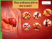 लिवर इन्फेक्शन में क्या नहीं खाना चाहिए? डॉक्टर से जानें, डाइट से जुड़ी महत्वपूर्ण बातें