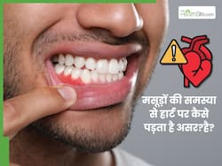 मसूड़ों की बीमारी से हार्ट को क्या नुकसान होता है? जानिए कैसे बढ़ता है एथेरोस्क्लेरोसिस का खतरा
