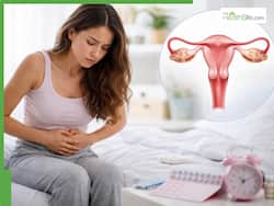 PCOS in young women: Why it   s rising in your 20s? Know early symptoms and ways to manage