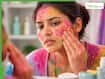 Post-Holi Skin Damage: 7 Common Problems Caused By Chemical Colours And How To Treat Them