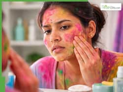 Post-Holi Skin Damage: 7 Common Problems Caused By Chemical Colours And How To Treat Them