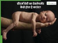 प्रीमेच्योर बेबी का डेवलपमेंट सही हो रहा है या नहीं? डॉक्टर से समझिए कैसे करें इसकी जांच
