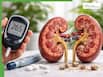 Rare side effects of high blood sugar levels: How does diabetes affect your kidneys and damage blood vessels