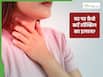 टॉन्सिल को जल्दी कैसे ठीक किया जाता है? डॉक्टरों ने बताया घर पर राहत पाने के आसान तरीके