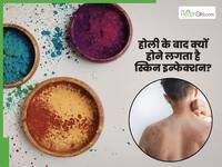 होली के बाद क्यों बढ़ जाता है स्किन इन्फेक्शन का खतरा? डर्मेटोलॉजिस्ट बता रहे हैं त्वचा को कैसे रखें सुरक्षित
