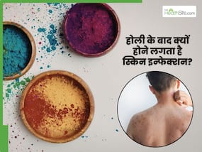 होली के बाद क्यों बढ़ जाता है स्किन इन्फेक्शन का खतरा? डर्मेटोलॉजिस्ट बता रहे हैं त्वचा को कैसे रखें सुरक्षित