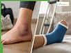 Sprain vs Fracture: Key signs to tell the difference and when to seek urgent care