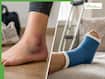 Sprain vs Fracture: Key signs to tell the difference and when to seek urgent care