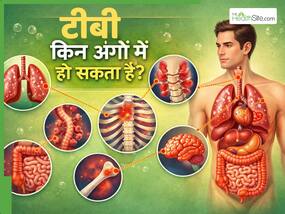 टीबी शरीर के किन अंगों को प्रभावित करता है? जानें कौन-से लक्षण हैं खतरनाक