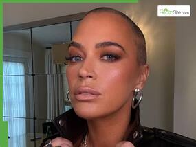 Teddi Mellencamp diagnosed with Stevens-Johnson syndrome: What to know about the rare skin disorder