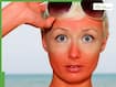 Too much Sun? The risks of prolonged unprotected sun exposure explained