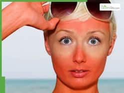 Too much Sun? The risks of prolonged unprotected sun exposure explained