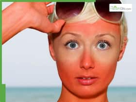 Too much Sun? The risks of prolonged unprotected sun exposure explained