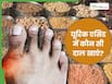 क्या यूरिक एसिड में सभी दालें छोड़ना है सही? जानिए Uric Acid में कौन सी दाल खाएं