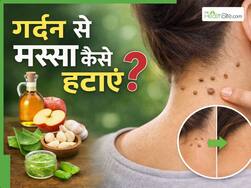 गर्दन पर मस्से हो जाए तो क्या करें? जानें 5 नुस्खे,  जिनसे साफ हो जाएगी स्किन